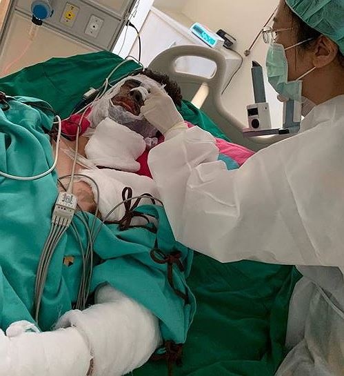 Chưa tìm ra thủ phạm tạt axit, cắt gân chân Việt kiều chua tim ra thu pham tat axit cat gan chan viet kieu tai quang ngai