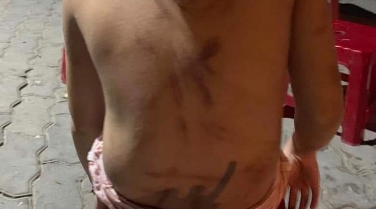 quang nam nghi chau trom do an ba danh chau da man