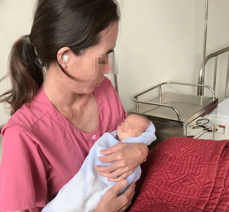 Huế: Cấp cứu thành công thai nhi dây rốn thắt nút hiếm gặp