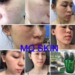 thuong hieu mq skin co lap lo lua doi nguoi tieu dung hay khong