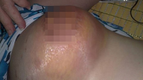 vong 1 sap se sau sinh me bim sua tra gia dat vi dai tu o tham my vien tu