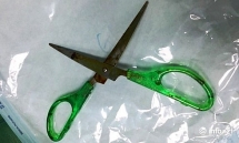 Bé gái ở Nghệ An bị bạn dùng kéo nhọn găm vào đầu