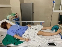 Cô gái bị co giật khi đang nâng ngực tại thẩm mỹ viện chui