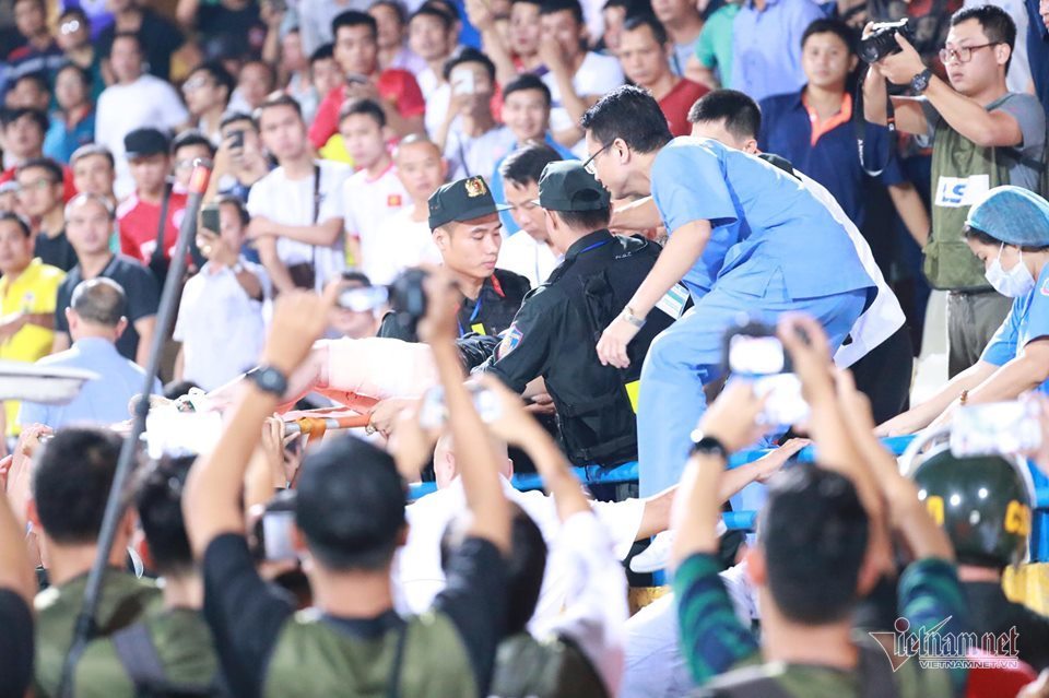 fan nu bi bong vi phao sang phai phau thuat 2 lan