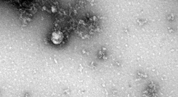 Hình ảnh hiển vi đầu tiên về biến thể mới virus SARS-CoV-2 phát hiện ở Anh