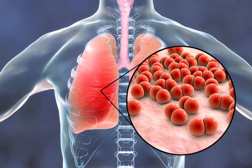 6 bệnh đường hô hấp thường gặp vào mùa lạnh 2021