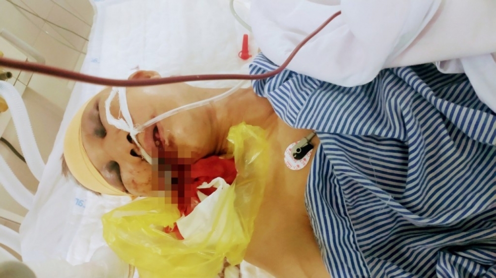 Hải Phòng: Tai nạn giao thông khiến một người nguy kịch