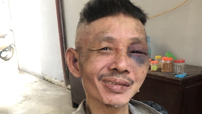 Vĩnh Phúc: Bắt giữ đối tượng có biểu hiện “ngáo đá” gây rối và đe dọa hàng xóm