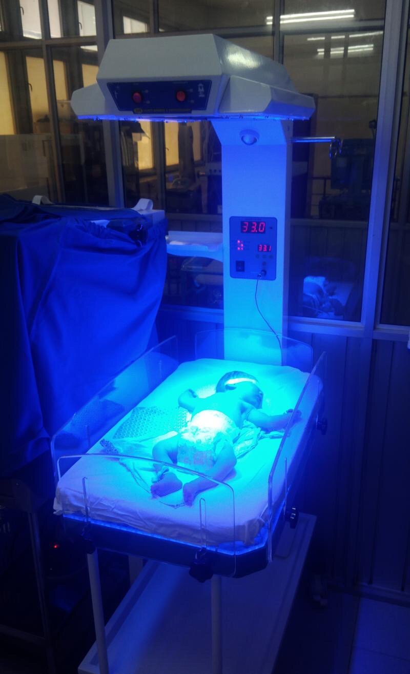 Chiếu đèn vàng da sơ sinh 