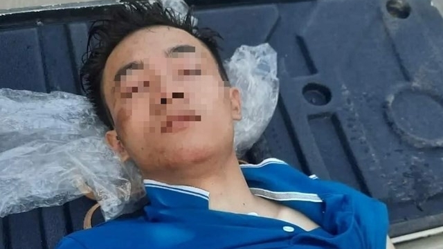 Nghệ An: Nam thanh niên nghi bị đánh "thừa sống thiếu chết"