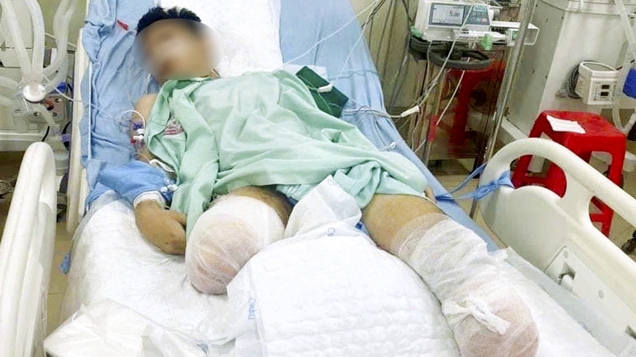 Vĩnh Phúc: Xét đặc cách tốt nghiệp THPT cho một học sinh bị tai nạn