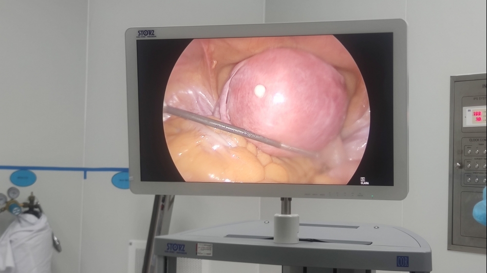 Trung tâm Y tế huyện cải tiến trang thiết bị phẫu thuật nội soi cắt tử cung