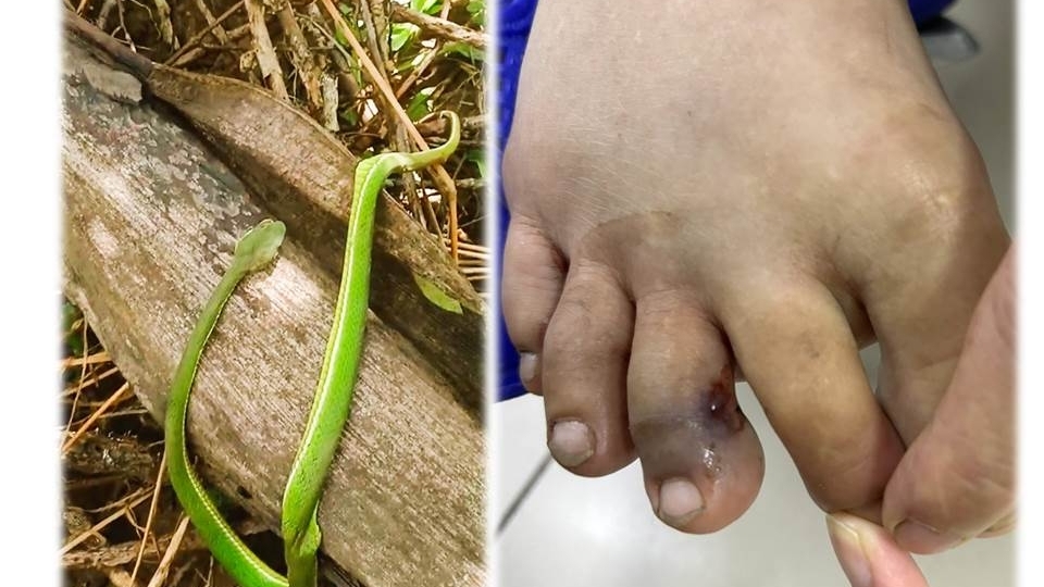 Phú Thọ: Rắn lục đuôi đỏ cắn, mối nguy hiểm trong mùa mưa