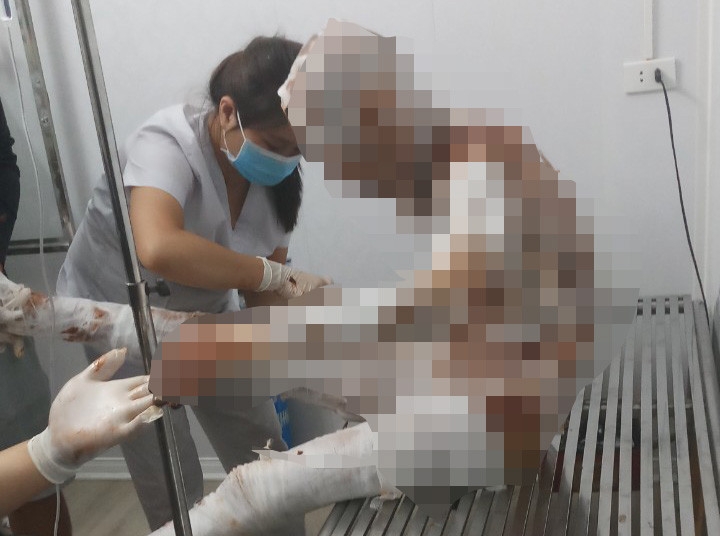 Ông T. đang được cấp cứu tại bệnh viện ở Hà Nội. Ảnh: Thành Đạt
