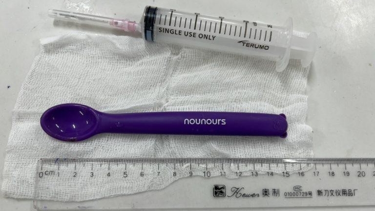 Vĩnh Phúc: Nhập viện cấp cứu cô gái 20 tuổi nuốt thìa nhựa 15cm vào bụng