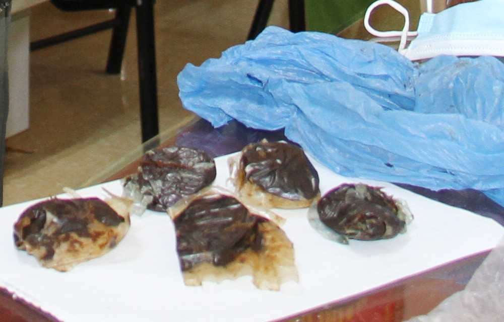 5 gói nilon chứa chất dẻo màu nâu đen mà Nguyễn Thế Ngọc khai nhận là thuốc phiện.