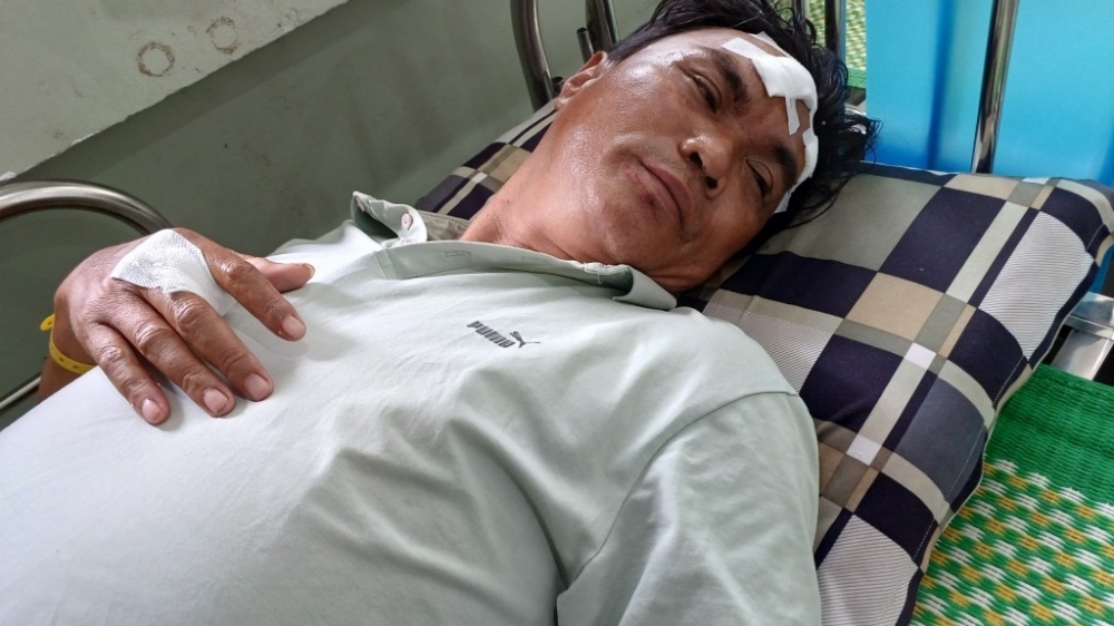 Quảng Nam: Xem World Cup, một người dân bị đánh trọng thương