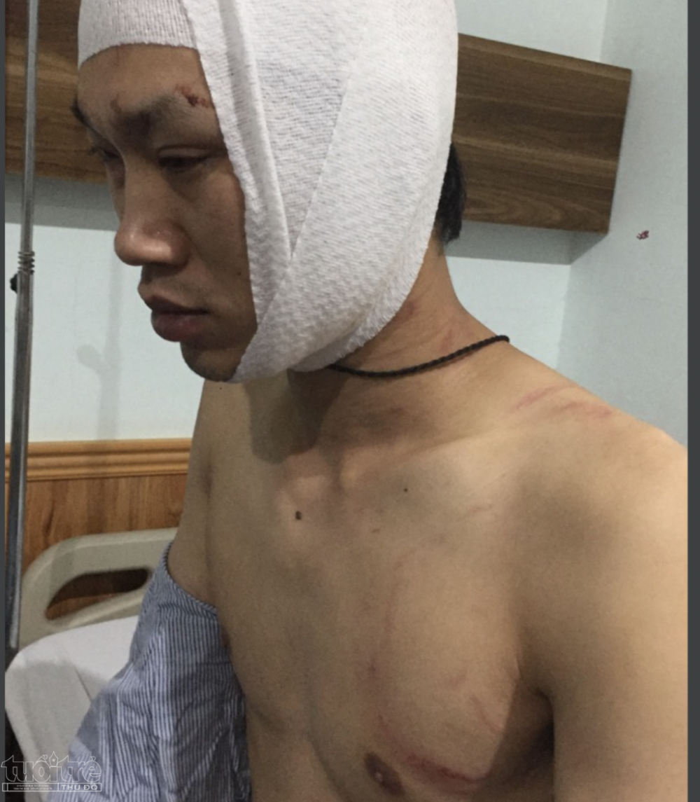 Anh Nguyễn Nhật Thành đang được điều trị tại Bệnh viện Việt - Tiệp