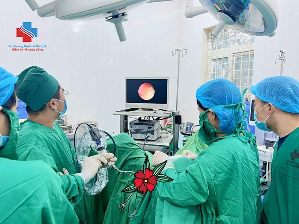 Hình ảnh các bác sĩ đang thực hiện tán sỏi nội soi niệu quản bằng laser