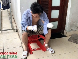 cong nhan cong ty tnhh seojin viet nam bi dap nat hai ban tay khi dang lam viec