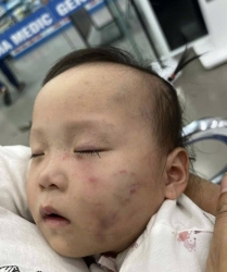 bac ninh chi dao lam ro thong tin be gai bi bam tim mat khi gui o nha tre