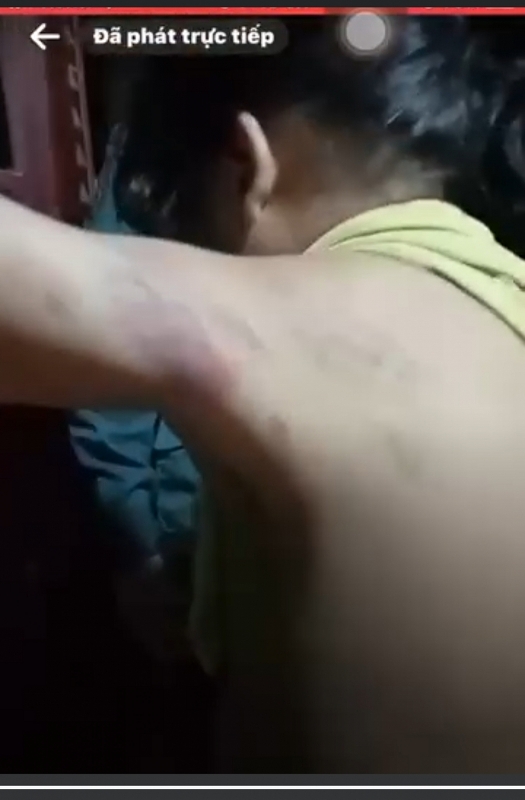 Bắc Giang: Đình chỉ tạm thời cô giáo bị phản ánh đánh học sinh ở Lục Nam