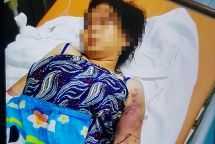 Giám định sức khỏe thai phụ bị tra tấn đến sảy thai