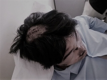 Nam sinh nhập viện điều trị tích cực vì bị đánh hội đồng