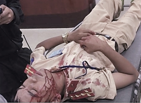 Kiểm tra phương tiện, Đại uý CSGT bị đối tượng dùng gạch đá tấn công