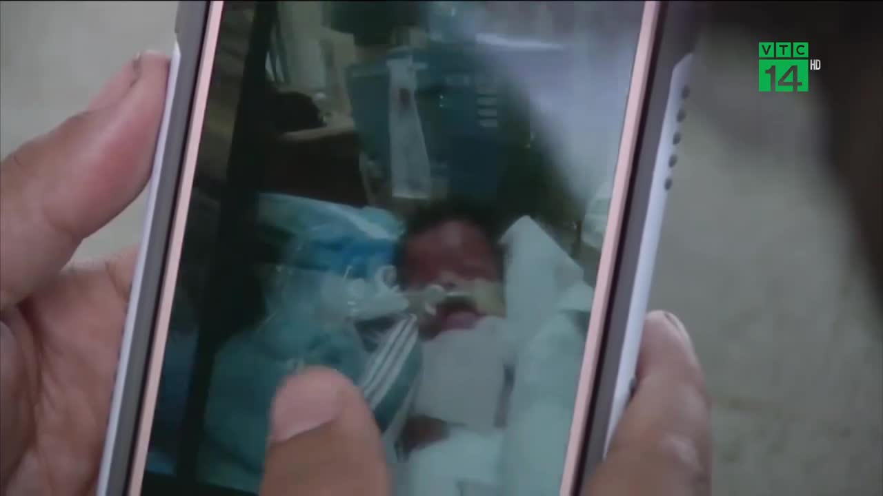 Bác sĩ chạy đua với thời gian cứu "em bé bươm bướm"