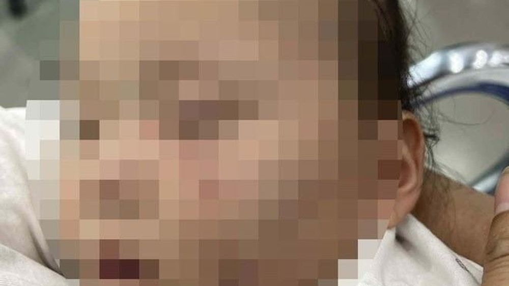 Bắc Ninh: Tạm giữ bảo mẫu nghi cố ý gây thương tích cho trẻ