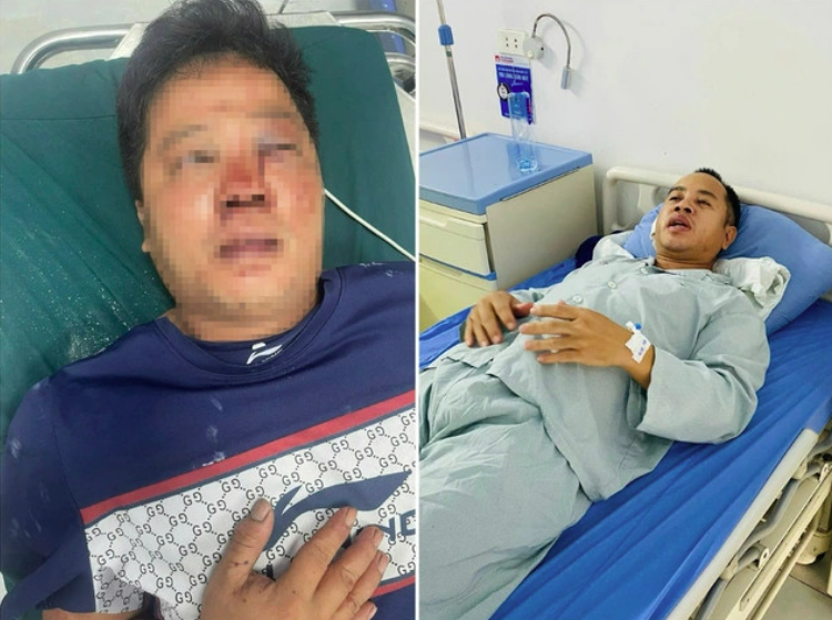 Hai anh em bị đánh dã man khi cứu người giữa đường: Công an Bắc Ninh vào cuộc điều tra