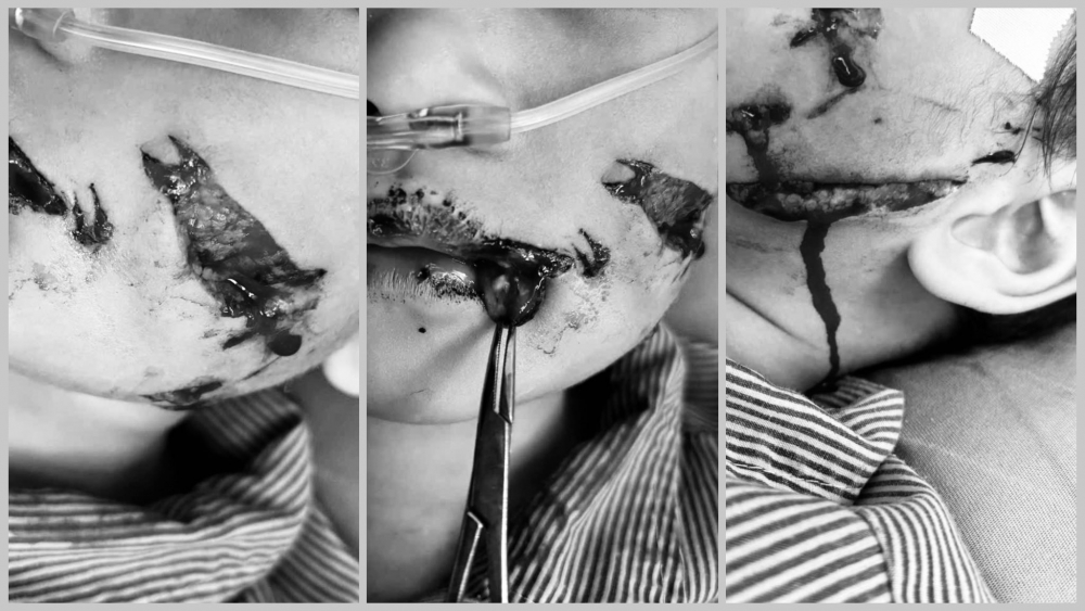 Cháu bé khi được nhập viện