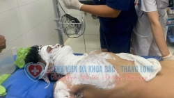 Bắc Giang: Người đàn ông bị bỏng nặng khi câu cá gần đường dây cao thế