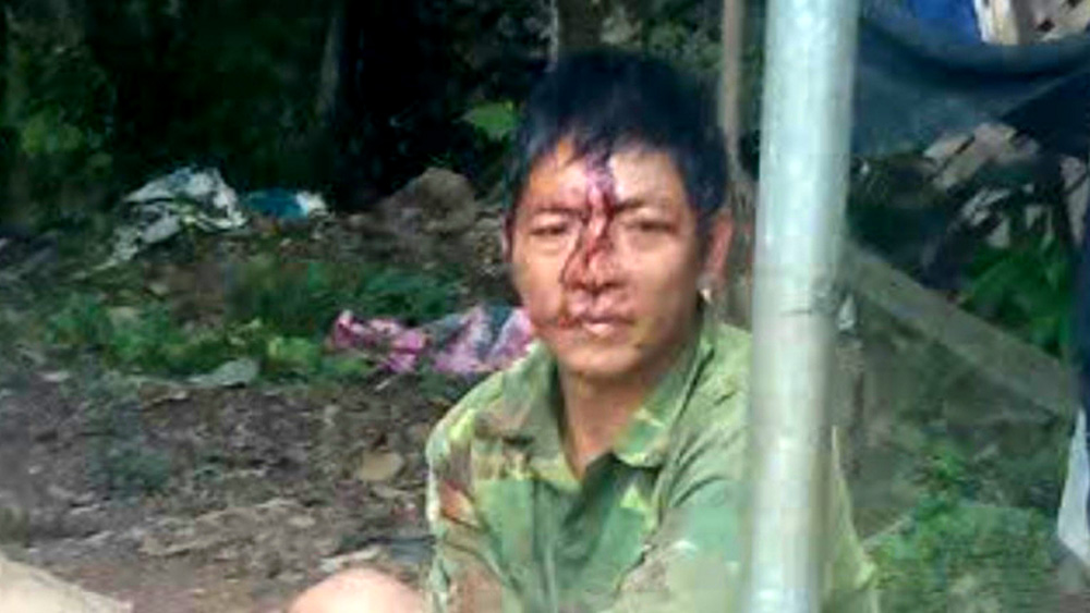 Bắc Giang: Chồng đánh vợ tử vong vì bị ngăn dùng điện thoại