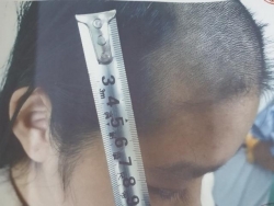 Cuộc sống “địa ngục” của bé gái 14 tuổi bị bố đẻ bạo hành mỗi khi “phê” ma tuý