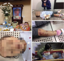 Vụ bé gái 3 tuổi tử vong nghi do mẹ đẻ và cha dượng bạo hành: Thủ phạm sẽ đối mặt với bản án gì?