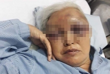 Con rể cũ đánh mẹ vợ tím mặt ở Hà Nội: Vì đâu nên nỗi