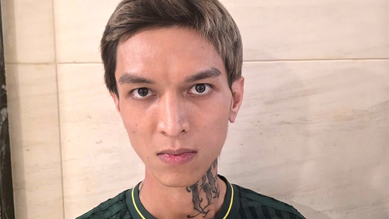 Bài học "Bình Gold": Khi sự nổi tiếng dẫn đến sa ngã