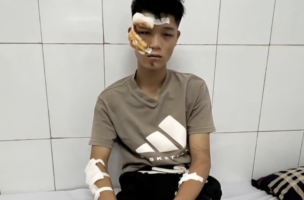 Đối tượng Nguyễn Văn Quân đang được điều trị tại bệnh viện