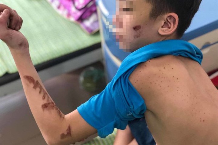 Từ nghi án chủ quán bánh xèo bạo hành nhân viên: Người nuôi con nhỏ dưới 36 tháng có bị xử lý hình sự?