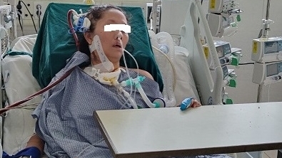 Suy đa tạng do lạm dụng corticoid tự điều trị cúm