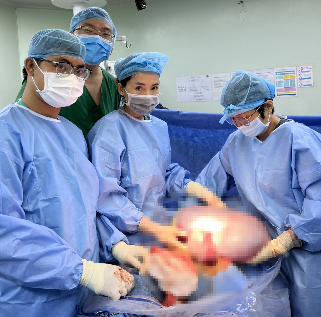 Phẫu thuật lấy thai đồng thời bóc khối u nặng 8kg thành công