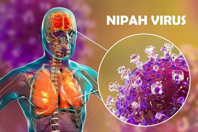 Hà Nội: Chủ động phòng, chống bệnh do virus Nipah Hà Nội: Chủ động phòng, chống bệnh do virus Nipah