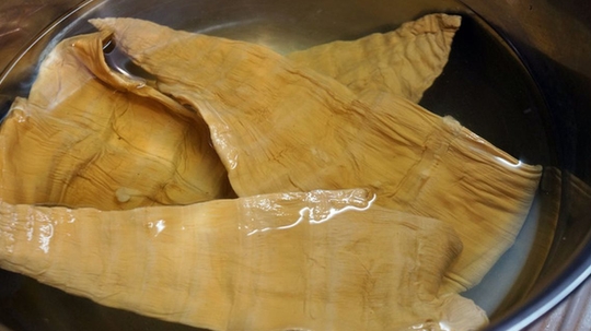 Cụ ông tắc ruột sau khi ăn canh măng lưỡi lợn