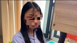 Một nữ sinh lớp 8 ở Hà Nội nghi bị đánh hội đồng