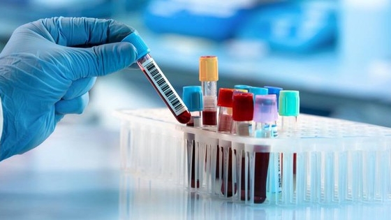 Xử lý cơ sở xét nghiệm không đảm bảo về an toàn sinh học