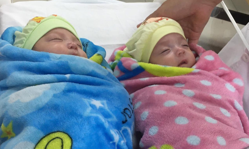 Cặp song sinh nặng 500g ở Hà Nội chào đời ở tuần thai thứ 25 được nuôi sống thành công