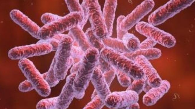 Bệnh nhi 15 tuổi tử vong vì mắc Whitmore