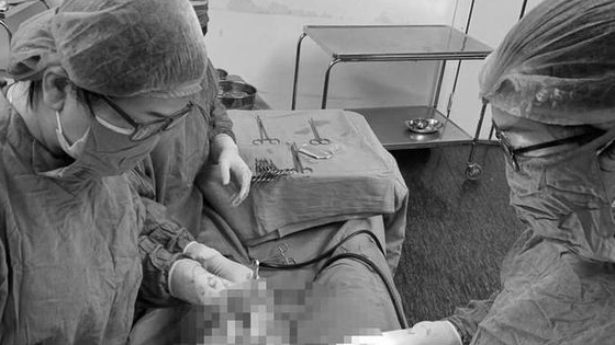 Quảng Ninh: Sản phụ mang thai đôi ở 2 tử cung khác nhau được mổ đẻ thành công